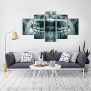 Xray See Through Dentist - Abstract 5 Panel Canvas Art Wall Decor